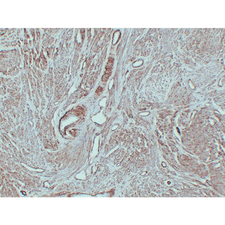 Immunohistochemistry - Anti-Caldesmon Antibody (V0012) - Antibodies.com