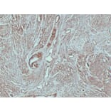 Immunohistochemistry - Anti-Caldesmon Antibody (V0012) - Antibodies.com