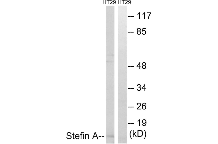 Western Blot - Anti-Stefin A Antibody (C0329) - Antibodies.com