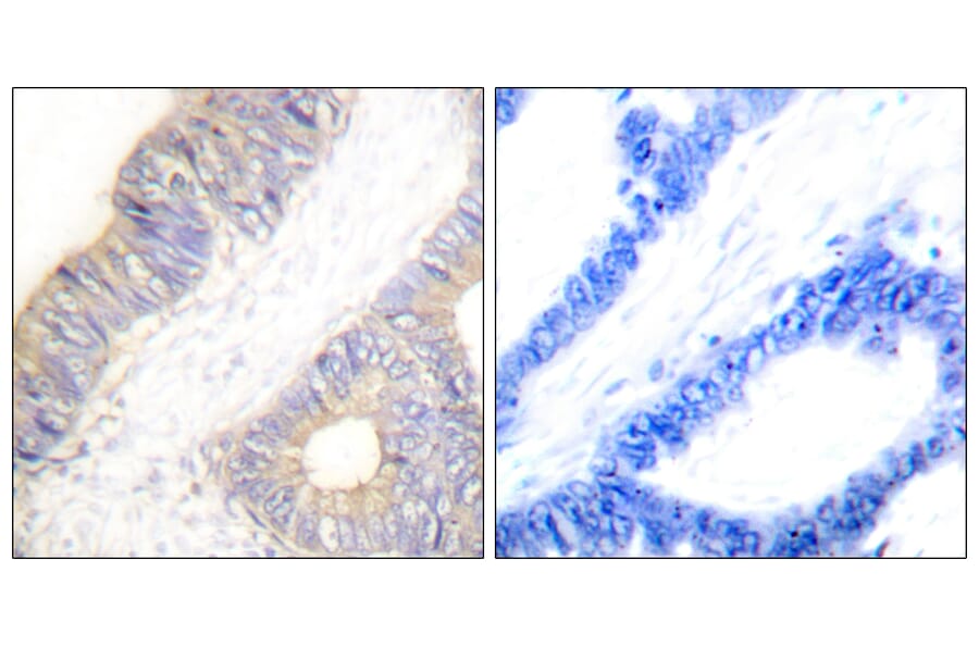Immunohistochemistry - Anti-Stefin A Antibody (C0329) - Antibodies.com