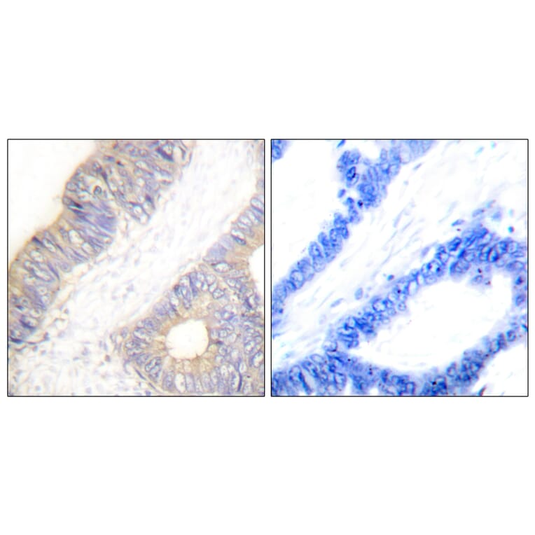 Immunohistochemistry - Anti-Stefin A Antibody (C0329) - Antibodies.com