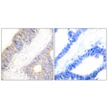 Immunohistochemistry - Anti-Stefin A Antibody (C0329) - Antibodies.com