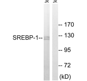 Western Blot - Anti-SREBP-1 Antibody (B8425) - Antibodies.com