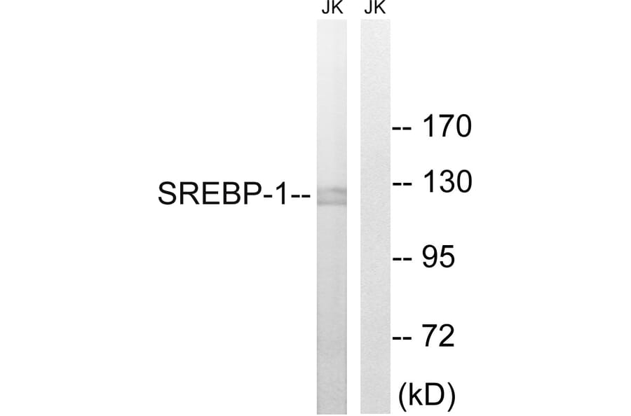Western Blot - Anti-SREBP-1 Antibody (B8425) - Antibodies.com