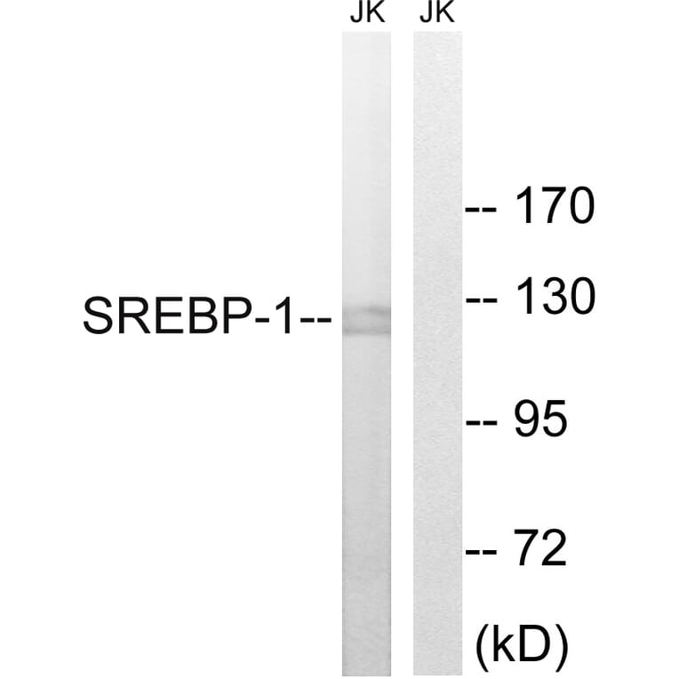Western Blot - Anti-SREBP-1 Antibody (B8425) - Antibodies.com