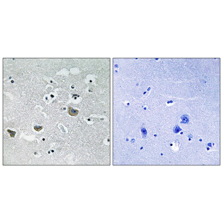 Immunohistochemistry - Anti-SREBP-1 Antibody (B8425) - Antibodies.com