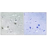 Immunohistochemistry - Anti-SREBP-1 Antibody (B8425) - Antibodies.com