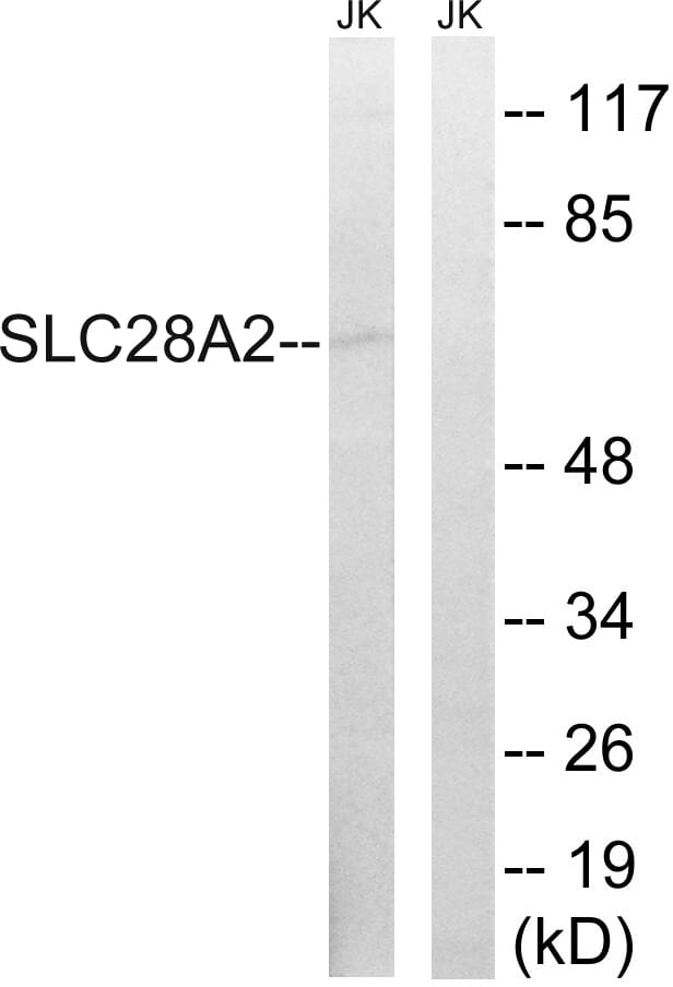Western blot analysis of lysates from Jurkat cells using Anti-SLC28A2 Antibody. The right hand lane represents a negative control, where the antibody is blocked by the immunising peptide.