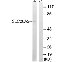 Western Blot - Anti-SLC28A2 Antibody (C18845) - Antibodies.com