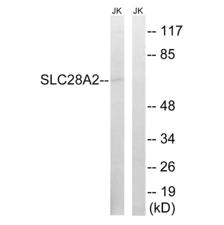 Western Blot - Anti-SLC28A2 Antibody (C18845) - Antibodies.com