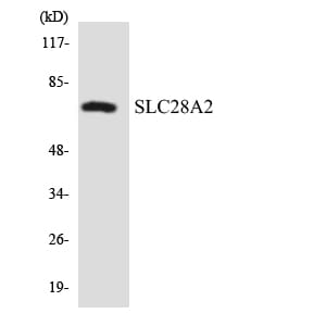 Western blot analysis of the lysates from HepG2 cells using Anti-SLC28A2 Antibody.