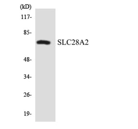 Western Blot - Anti-SLC28A2 Antibody (R12-3523) - Antibodies.com
