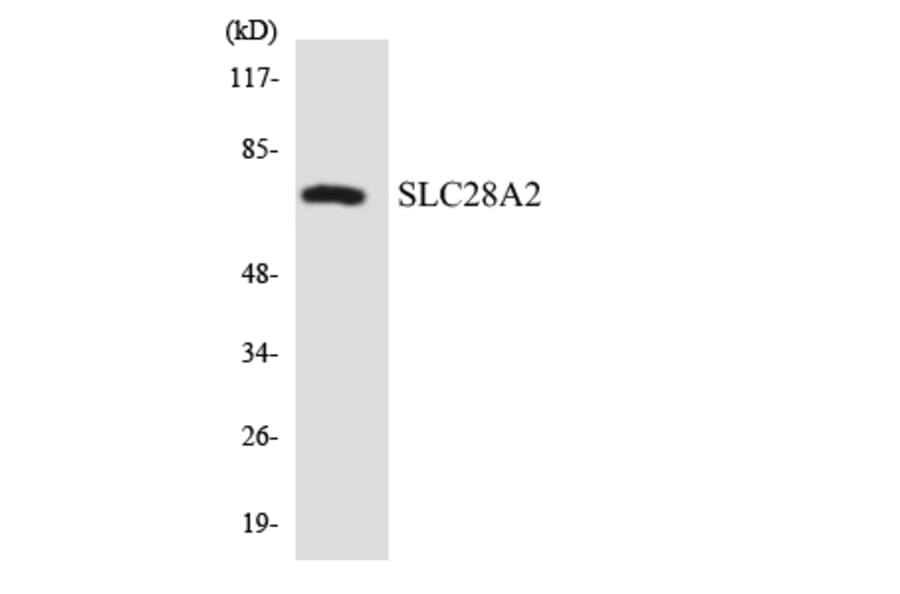 Western Blot - Anti-SLC28A2 Antibody (R12-3523) - Antibodies.com