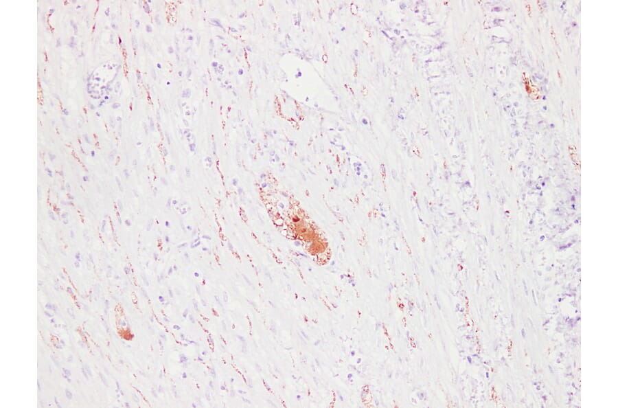 Immunohistochemistry - Anti-PGP 9.5 Antibody (V0110) - Antibodies.com
