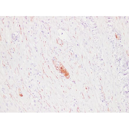 Immunohistochemistry - Anti-PGP 9.5 Antibody (V0110) - Antibodies.com