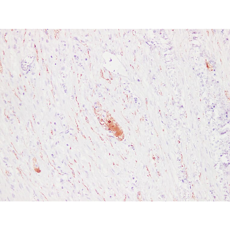 Immunohistochemistry - Anti-PGP 9.5 Antibody (V0110) - Antibodies.com