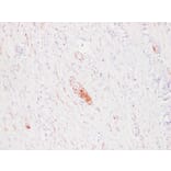 Immunohistochemistry - Anti-PGP 9.5 Antibody (V0110) - Antibodies.com