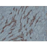 Immunohistochemistry - Anti-PGP 9.5 Antibody (V0110) - Antibodies.com