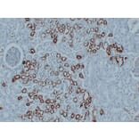 Immunohistochemistry - Anti-PGP 9.5 Antibody (V0110) - Antibodies.com