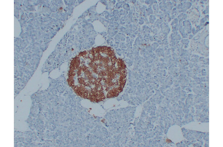 Immunohistochemistry - Anti-PGP 9.5 Antibody (V0110) - Antibodies.com