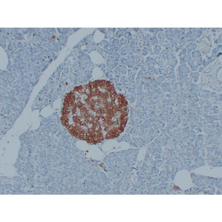 Immunohistochemistry - Anti-PGP 9.5 Antibody (V0110) - Antibodies.com