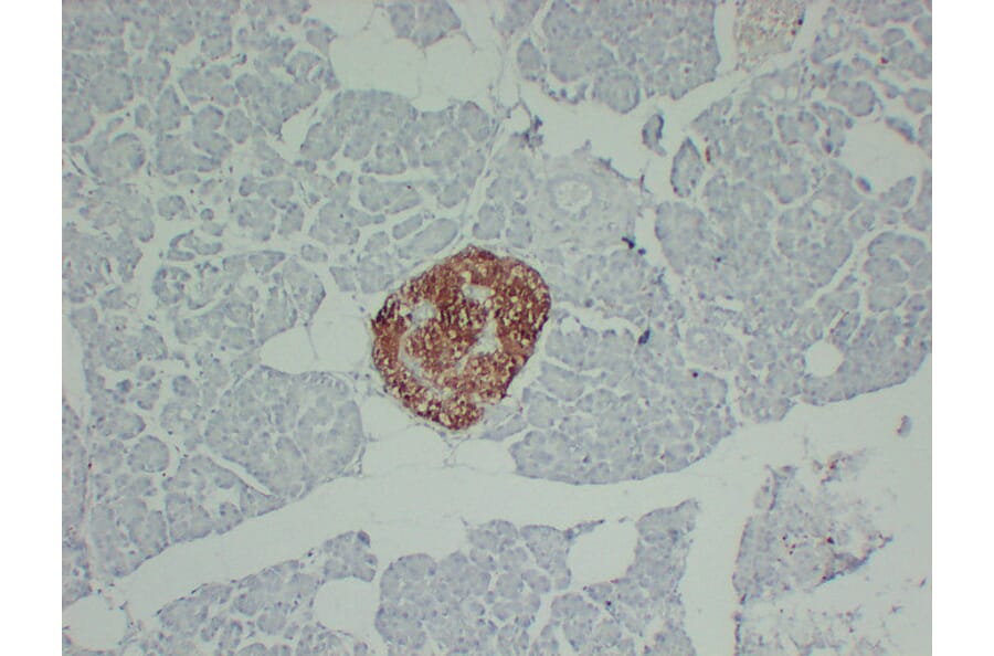 Immunohistochemistry - Anti-PGP 9.5 Antibody (V0110) - Antibodies.com