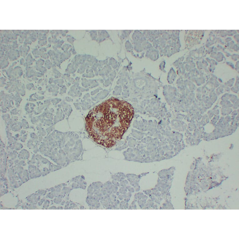 Immunohistochemistry - Anti-PGP 9.5 Antibody (V0110) - Antibodies.com