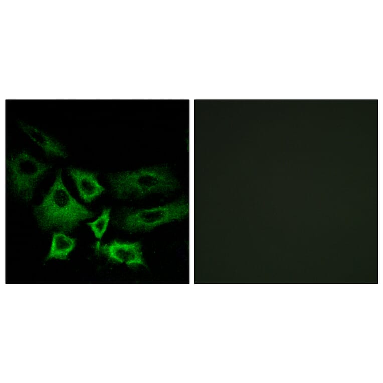 Immunofluorescence - Anti-NT5C1A Antibody (C15296) - Antibodies.com