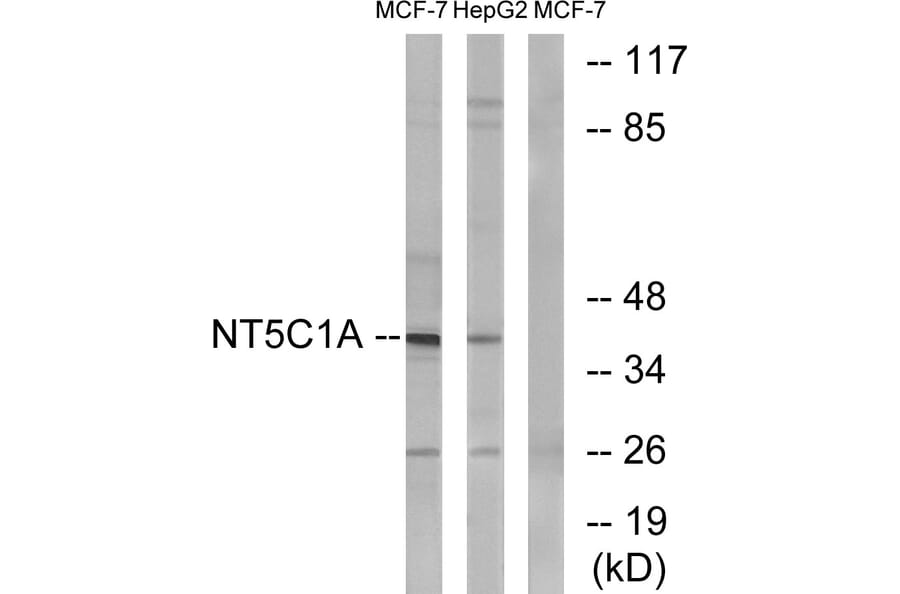 Western Blot - Anti-NT5C1A Antibody (C15296) - Antibodies.com