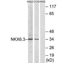Western Blot - Anti-NKX6.3 Antibody (C10009) - Antibodies.com