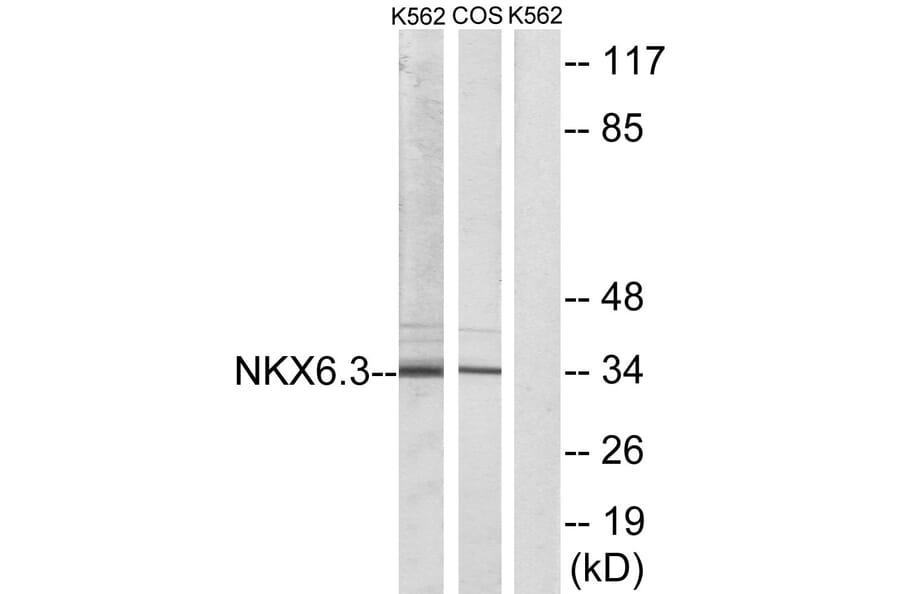 Western Blot - Anti-NKX6.3 Antibody (C10009) - Antibodies.com