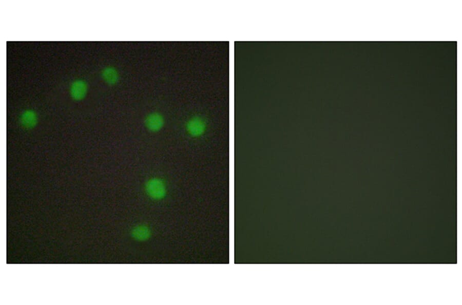 Immunofluorescence - Anti-NKX6.3 Antibody (C10009) - Antibodies.com