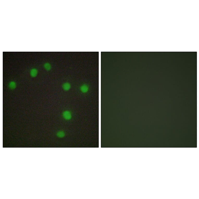 Immunofluorescence - Anti-NKX6.3 Antibody (C10009) - Antibodies.com