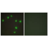 Immunofluorescence - Anti-NKX6.3 Antibody (C10009) - Antibodies.com