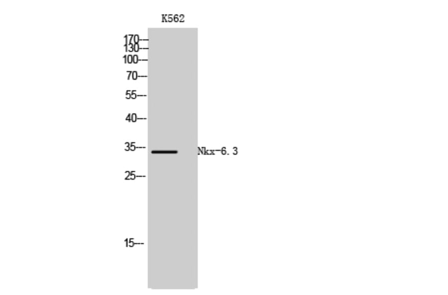 Western Blot - Anti-NKX6.3 Antibody (C10009) - Antibodies.com