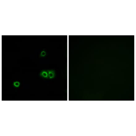 Immunofluorescence - Anti-MARCH5 Antibody (C15550) - Antibodies.com