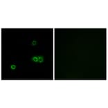 Immunofluorescence - Anti-MARCH5 Antibody (C15550) - Antibodies.com