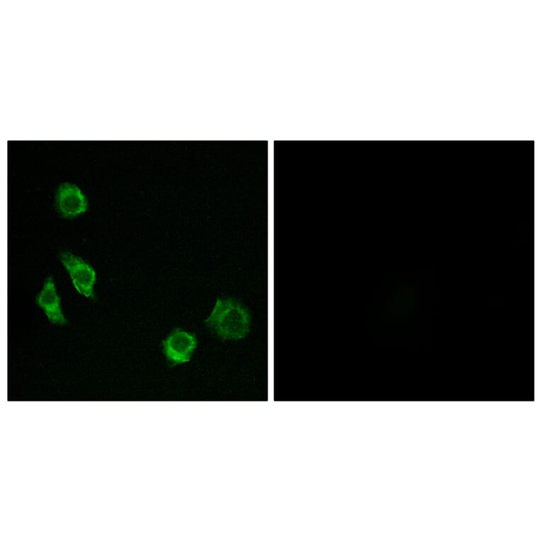 Immunofluorescence - Anti-GPRC5D Antibody (G320) - Antibodies.com