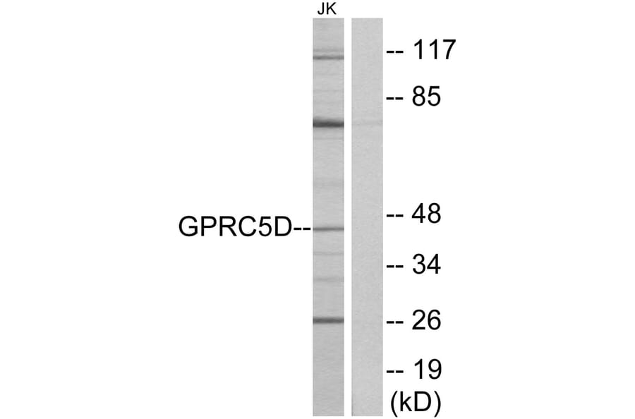 Western Blot - Anti-GPRC5D Antibody (G320) - Antibodies.com