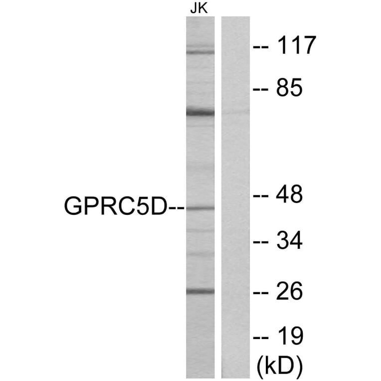 Western Blot - Anti-GPRC5D Antibody (G320) - Antibodies.com