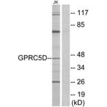 Western Blot - Anti-GPRC5D Antibody (G320) - Antibodies.com