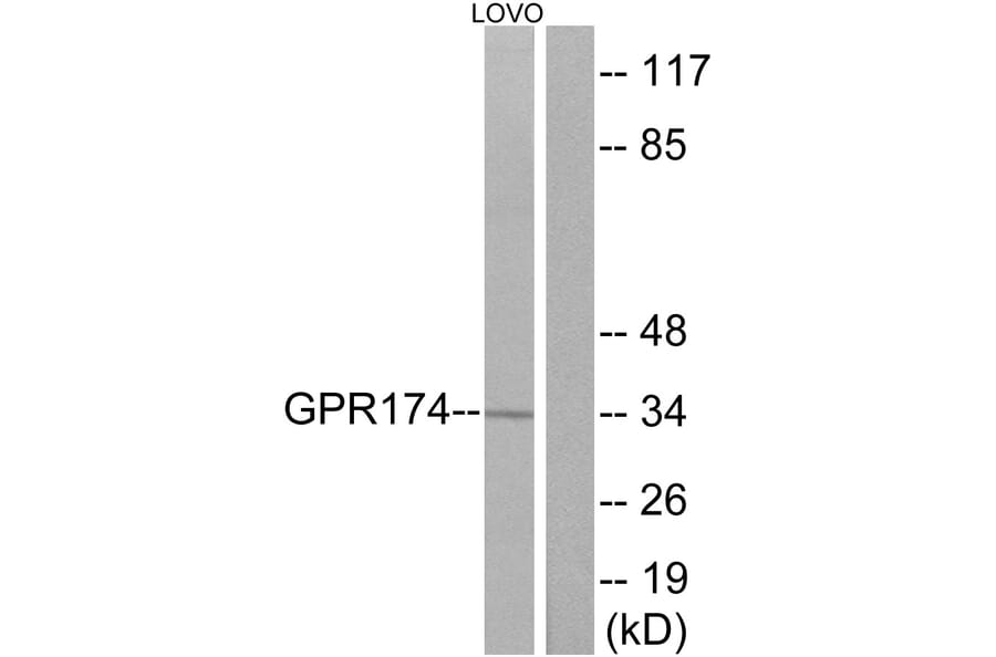 Western Blot - Anti-GPR174 Antibody (G145) - Antibodies.com