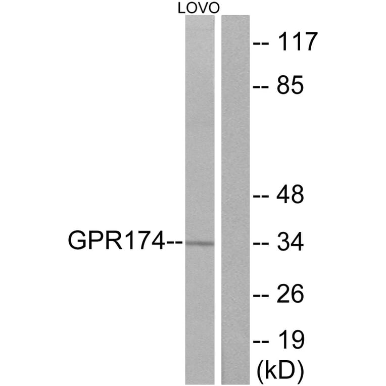 Western Blot - Anti-GPR174 Antibody (G145) - Antibodies.com