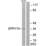 Western Blot - Anti-GPR174 Antibody (G145) - Antibodies.com