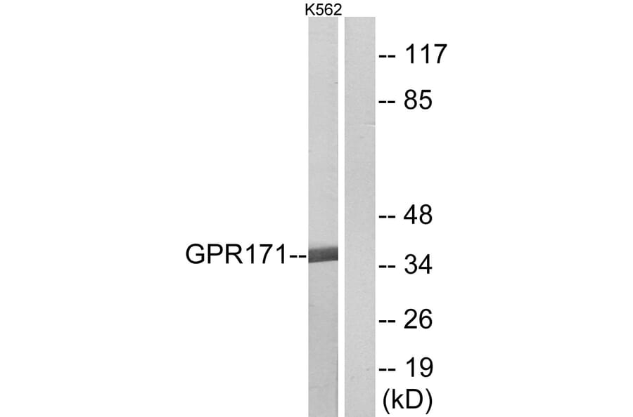 Western Blot - Anti-GPR171 Antibody (G143) - Antibodies.com