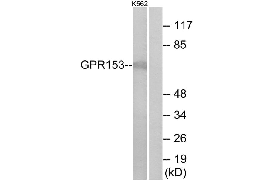 Western Blot - Anti-GPR153 Antibody (G139) - Antibodies.com