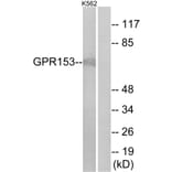 Western Blot - Anti-GPR153 Antibody (G139) - Antibodies.com