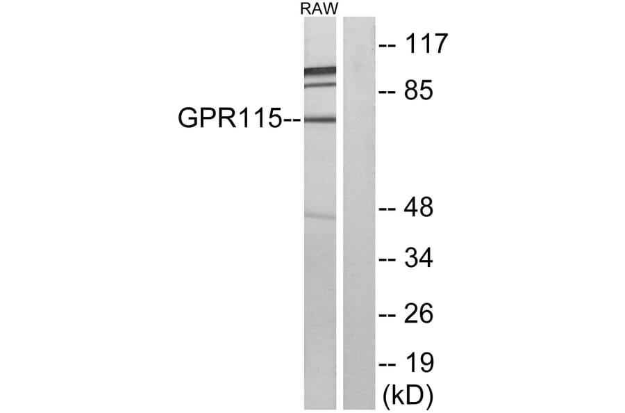 Western Blot - Anti-GPR115 Antibody (G123) - Antibodies.com