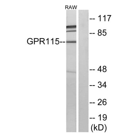 Western Blot - Anti-GPR115 Antibody (G123) - Antibodies.com