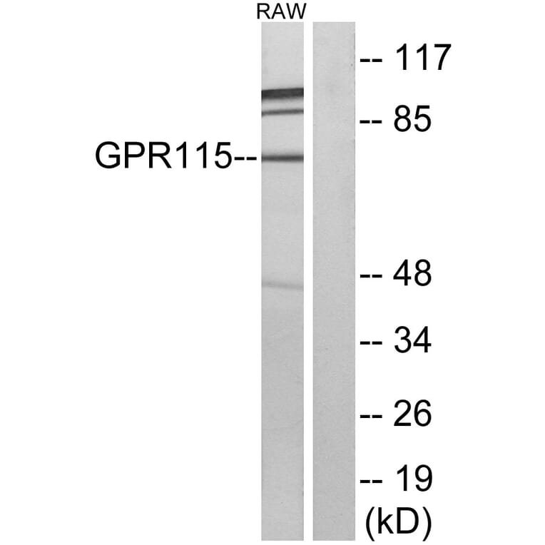 Western Blot - Anti-GPR115 Antibody (G123) - Antibodies.com